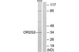 Western blot analysis of extracts from RAW264. (OR2G2 antibody  (AA 241-290))