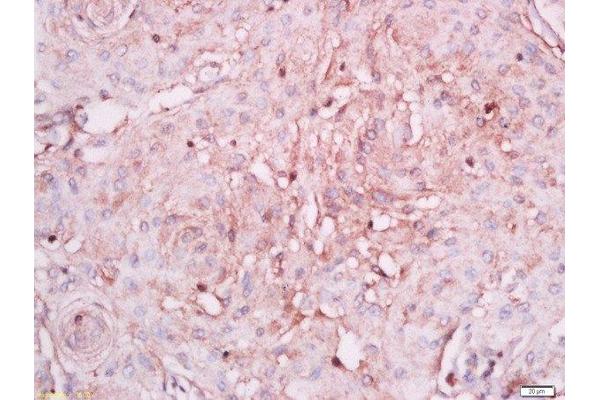 NINJ1 antibody  (AA 1-80)