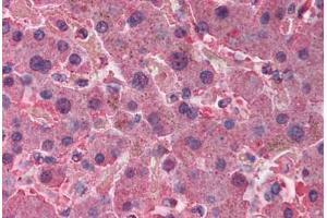 Human Liver (formalin-fixed, paraffin-embedded) stained with AHSG antibody ABIN291878 at 2. (Fetuin A antibody)