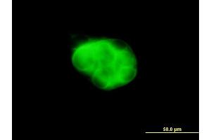 Immunofluorescence of monoclonal antibody to DCAKD on MCF-7 cell. (DCAKD antibody  (AA 113-200))