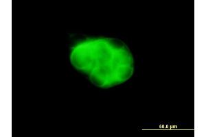 Immunofluorescence of monoclonal antibody to DCAKD on MCF-7 cell. (DCAKD antibody  (AA 113-200))