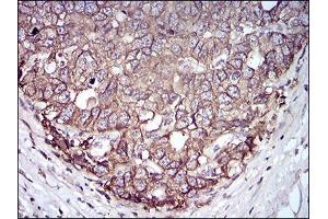 Immunohistochemistry (IHC) image for anti-Epithelial Cell Adhesion Molecule (EPCAM) (AA 24-265) antibody (ABIN2682989)