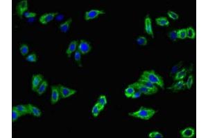 Immunofluorescent analysis of HepG2 cells using ABIN7159312 at dilution of 1:100 and Alexa Fluor 488-congugated AffiniPure Goat Anti-Rabbit IgG(H+L) (MFI2 antibody  (AA 20-302))