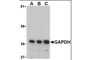 Western Blotting (WB) image for anti-Glyceraldehyde-3-Phosphate Dehydrogenase (GAPDH) (N-Term) antibody (ABIN2473761) (GAPDH antibody  (N-Term))