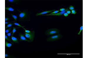 Immunofluorescence of purified MaxPab antibody to FUK on HeLa cell. (FUK antibody  (AA 1-1084))