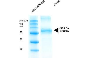 SDS-PAGE of 90 kDa Hsp90 beta protein (ABIN1686666, ABIN1686667 and ABIN1686668). (HSP90AB1 Protein (full length))