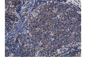 Immunohistochemical staining of paraffin-embedded Human colon tissue using anti-DNAJA2 mouse monoclonal antibody.
