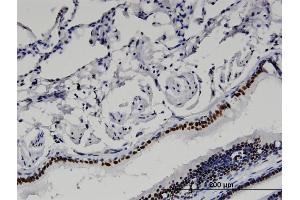 Immunoperoxidase of monoclonal antibody to BAZ2B on formalin-fixed paraffin-embedded human lung. (BAZ2B antibody  (AA 1833-1931))