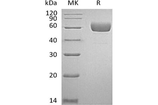 SERPINA7 Protein (His tag)