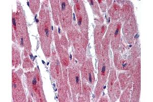 Immunohistochemistry (IHC) image for anti-RNA Binding Motif Protein 24 (RBM24) (Middle Region) antibody (ABIN2776655) (RBM24 antibody  (Middle Region))