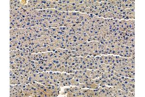 ABIN7096566 and ABIN7100630 at 1/100 staining mouse liver tissue by IHC-P. (FUNDC1 antibody)