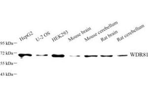 Western blot analysis of WDR81 (ABIN7076221) at dilution of 1: 1000