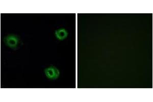 Immunofluorescence analysis of A549 cells, using NTR2 Antibody. (NTSR2 antibody  (AA 151-200))