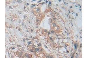 Immunohistochemistry (IHC) image for anti-V-Akt Murine Thymoma Viral Oncogene Homolog 3 (Protein Kinase B, Gamma) (AKT3) (AA 46-338) antibody (ABIN7431704)