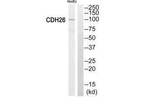 Western blot analysis of extracts from HuvEc cells, using Cytochrome P450 2C8 antiobdy. (CYP2C8 antibody)