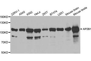 Western blot analysis of extracts of various cell lines, using AP2B1 antibody (ABIN5971039) at 1/1000 dilution. (AP2B1 antibody)
