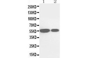 Anti-Cytochrome P450 2E1 antibody, Western blotting Lane 1: Rat Liver Tissue Lysate Lane 2: Mouse Liver Tissue Lysate (CYP2E1 antibody  (N-Term))