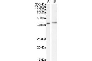 ABIN184711 (0. (CYTIP antibody  (N-Term))