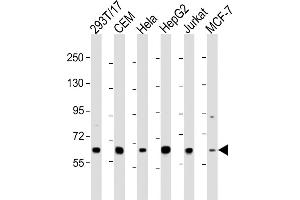 All lanes : Anti-RNF31 Antibody (C-term) at 1:2000 dilution Lane 1: 293T/17 whole cell lysate Lane 2: CEM whole cell lysate Lane 3: Hela whole cell lysate Lane 4: HepG2 whole cell lysate Lane 5: Jurkat whole cell lysate Lane 6: MCF-7 whole cell lysate Lysates/proteins at 20 μg per lane. (RNF31 antibody  (C-Term))
