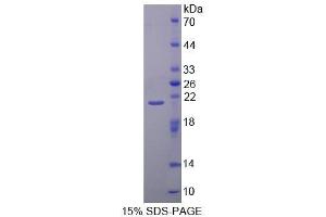 SDS-PAGE (SDS) image for Calpain 1 (CAPN1) (AA 185-356) protein (His tag) (ABIN1169983)