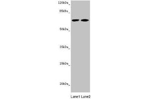 Western blot All lanes: STXBP2 antibody at 5. (STXBP2 antibody  (AA 1-280))