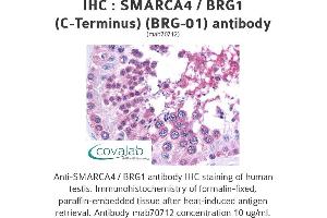 Image no. 2 for anti-SWI/SNF Related, Matrix Associated, Actin Dependent Regulator of Chromatin, Subfamily A, Member 4 (SMARCA4) (C-Term) antibody (ABIN1723569) (SMARCA4 antibody  (C-Term))