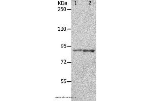 Western blot analysis of 293T cell and mouse brain tissue, using KCNC3 Polyclonal Antibody at dilution of 1:300 (KCNC3 antibody)