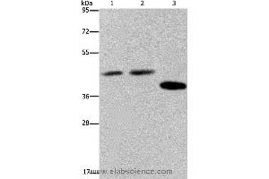 Western blot analysis of Hela, 293T and LO2 cell, using SERPINB3 Polyclonal Antibody at dilution of 1:400