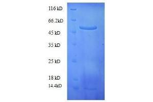 SDS-PAGE (SDS) image for Ribulose-1,5-Bisphosphate Carboxylase/oxygenase (Chloroplast) (RBCL) (full length) protein (ABIN7479556) (RBCL Protein (full length))