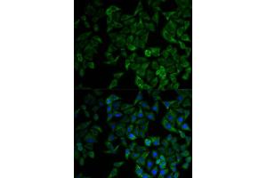 Immunofluorescence analysis of HeLa cell using TNFRSF1A antibody. (TNFRSF1A antibody  (AA 22-211))