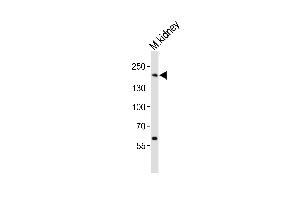 Western blot analysis of lysate from mouse kidney tissue lysate, using Erbb2 Antibody  (ABIN6243606 and ABIN6577675). (ErbB2/Her2 antibody  (AA 1142-1176))