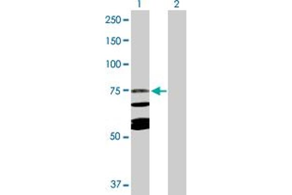 CAPN10 anticorps  (AA 1-672)