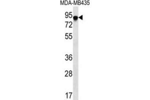 Western Blotting (WB) image for anti-FYN-Binding Protein (FYB) antibody (ABIN2996649)