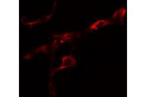 ABIN6274624 staining Hela cells by IF/ICC. (COL6A2 antibody  (Internal Region))