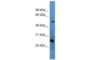 WB Suggested Anti-C1QA Antibody Titration: 0. (C1QA antibody  (N-Term))