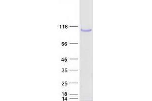 Validation with Western Blot (PLOD2 Protein (Transcript Variant 1) (Myc-DYKDDDDK Tag))