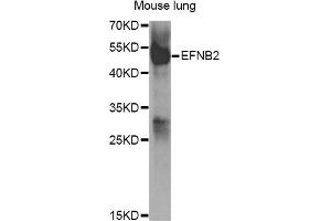 Western blot analysis of extracts of mouse lung, using EFNB2 antibody (ABIN5973311) at 1/1000 dilution. (Ephrin B2 antibody)
