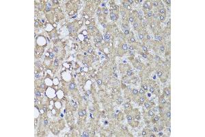 Immunohistochemistry of paraffin-embedded human liver injury using PIK3C2A antibody (ABIN5995585) at dilution of 1/100 (40x lens). (PIK3C2A antibody)