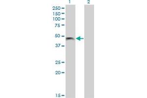 Western Blot analysis of PHF7 expression in transfected 293T cell line by PHF7 monoclonal antibody (M13), clone 3F3. (PHF7 antibody  (AA 258-357))