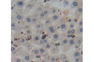 Used in DAB staining on fromalin fixed paraffin- embedded Kidney tissue (Poliovirus Receptor antibody  (AA 22-255))