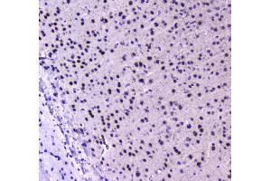 IHC analysis of RUNX1T1/ETO using anti-RUNX1T1/ETO antibody . (RUNX1T1 antibody  (AA 335-510))