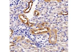 Immunohistochemistry analysis of paraffin-embedded mouse kidney using,TSPAN1 (ABIN7075867) at dilution of 1: 4000 (TSPAN1 antibody)
