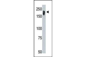 Image no. 1 for anti-Nuclear Receptor Co-Repressor 1 (NCOR1) (N-Term) antibody (ABIN356671) (NCOR1 antibody  (N-Term))