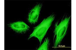 Immunofluorescence of monoclonal antibody to TUBB2A on HeLa cell. (TUBB2A antibody  (AA 1-445))