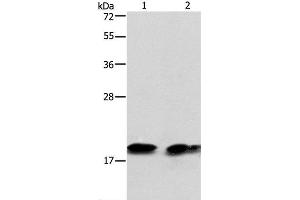 Western Blot analysis of Mouse brain tissue and NIH/3T3 cell using SKP1 Polyclonal Antibody at dilution of 1:550 (SKP1 antibody)