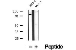 Western blot analysis of extracts of MCF-7 cells, using BBS10 antibody. (BBS10 antibody  (Internal Region))