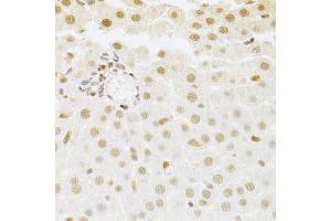 Immunohistochemistry of paraffin-embedded rat liver using SFN Antibody. (14-3-3 sigma/SFN antibody  (AA 1-248))