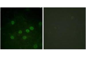 Immunofluorescence analysis of HuvEc cells treated with serum 20% 30', using Histone H1 (Phospho-Thr17) Antibody. (Histone H1 antibody  (pSer17))