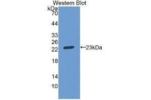 Western blot analysis of the recombinant protein. (Aconitase 1 antibody  (AA 527-719))