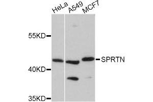 Western blot analysis of extracts of various cell lines, using SPRTN Antibody (ABIN5998942) at 1:3000 dilution. (Spartan antibody)